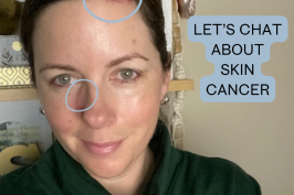Let’s Chat Skin Cancer: My Story